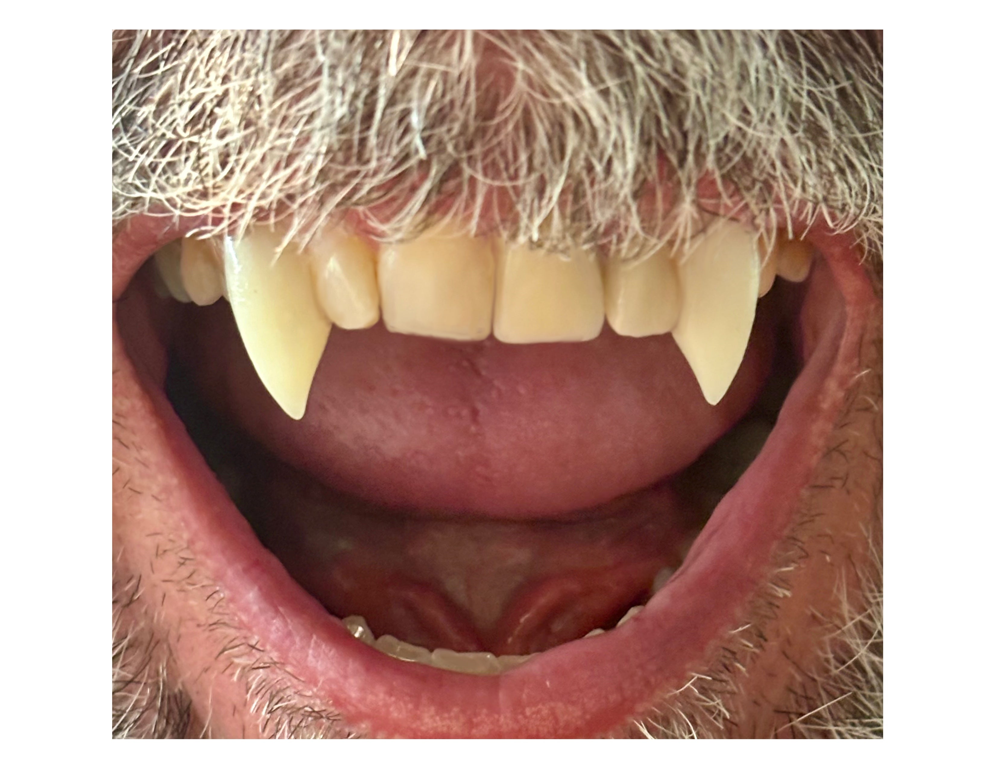 Vampire Fang Caps- 3 Styles!!
